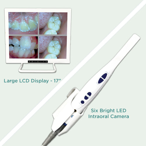 AccuVue IntraOral Camera - Vitalticks PVT LTD