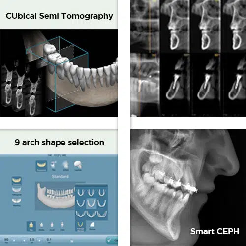 Genoray Papaya OPG - CUST