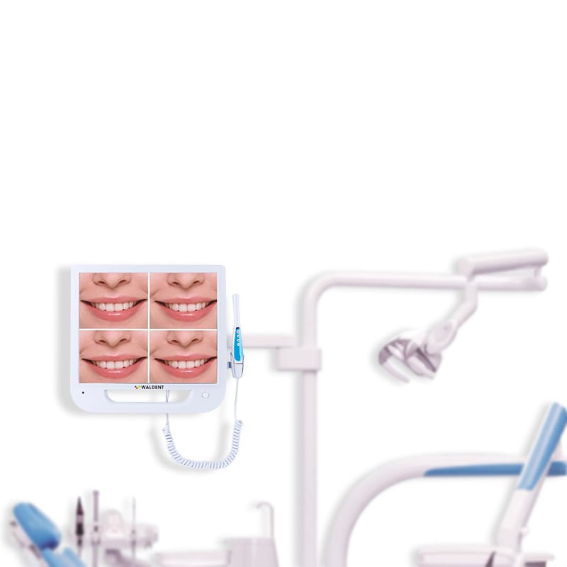 Waldent Intra Oral Camera with Screen - Ergo (10 MP) - Vitalticks PVT LTD