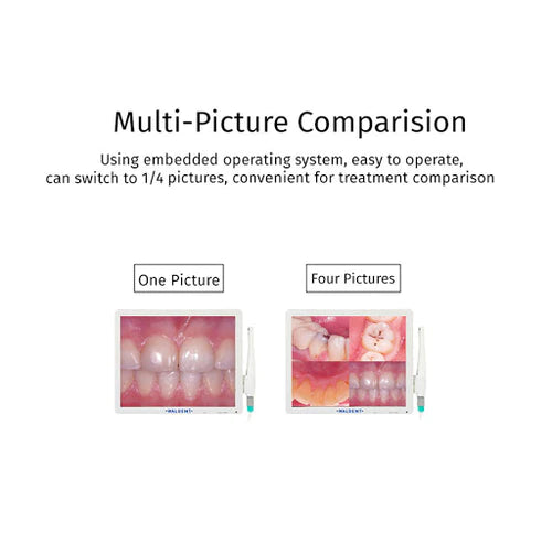 Waldent Intraoral Camera Smart - Cam with PMS - Vitalticks