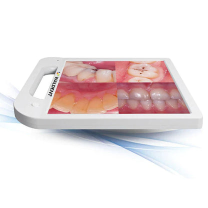 Waldent Intra Oral Camera with Screen - Ergo (10 MP) - Vitalticks