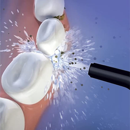ORACURA Smart PLUS Water Flosser OC200 With 5 Tips - Vitalticks PVT LTD