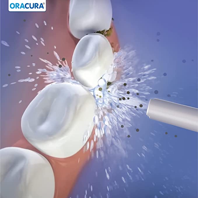 ORACURA Smart Water Flosser OC100 - Vitalticks PVT LTD