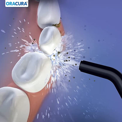 ORACURA Smart Water Flosser OC010 Without Protective Case - Vitalticks PVT LTD