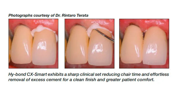 Shofu Fx Ultra Glass Ionomer Restorative -Mini Set Shofu Hy-Bond Glasionomer CX-Smart Luting Cement Set 