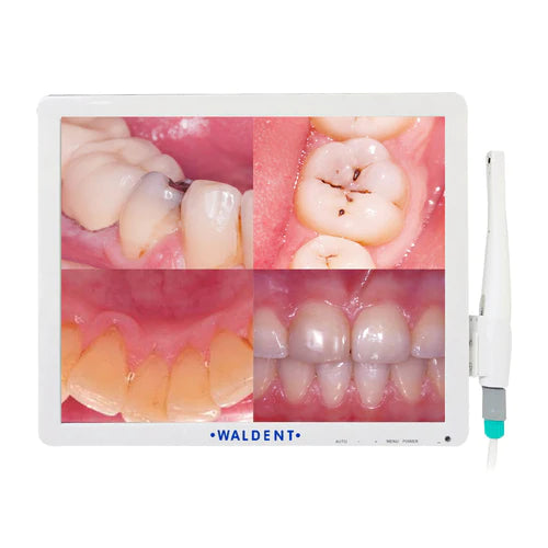 Waldent Intraoral Camera Smart - Cam with PMS - Vitalticks